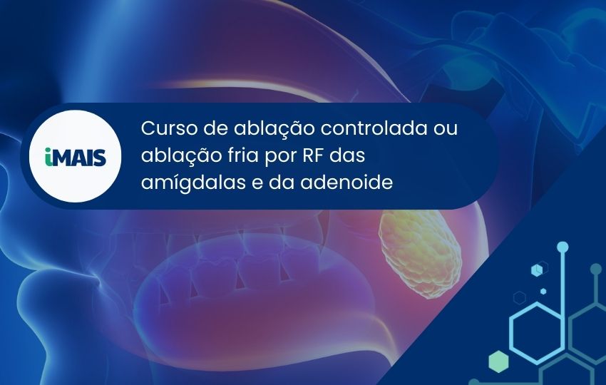 Curso de ablação controlada ou ablação fria por RF das amígdalas e da adenoide