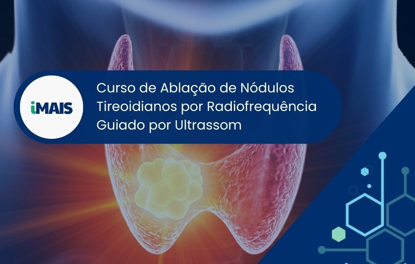 Curso de Ablação de Nódulos Tireoidianos por Radiofrequência Guiado por Ultrassom