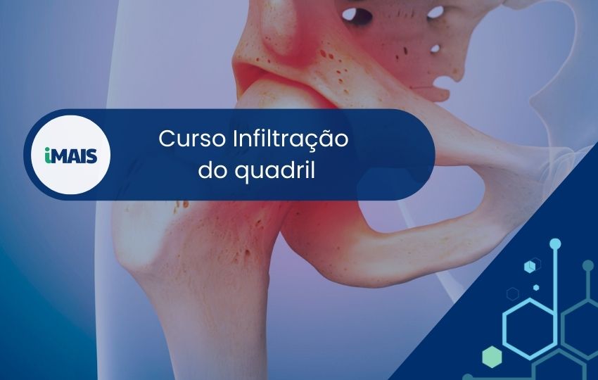 Curso Infiltração do Quadril